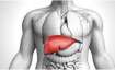 Fatty Liver